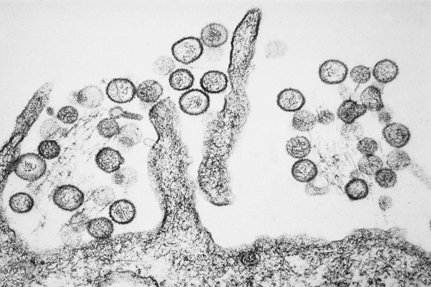 Hantavirus Di RI Ternyata Tipe Berbeda, Kemenkes Ungkap Varian Yang Beredar Di Indonesia