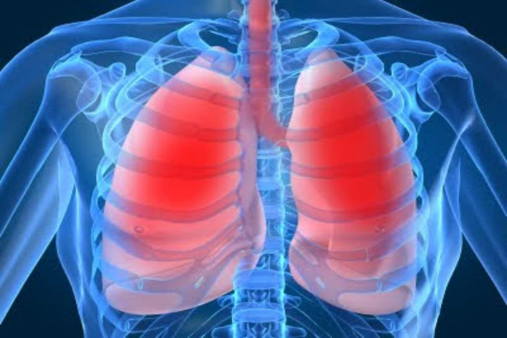 Lung Cryoablation Jadi Opsi Saat Operasi Tak Mungkin, Tumor Paru Dibekukan Tanpa Banyak Nyeri