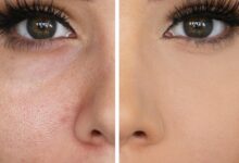 5 Cushion Andalan untuk Samarkan Pori-Pori Besar, Makeup Tampak Lebih Mulus