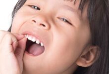 Gigi Berlubang Bukan Cuma Soal Nyeri, Ini Dampak yang Diam-Diam Ganggu Tumbuh Kembang Anak