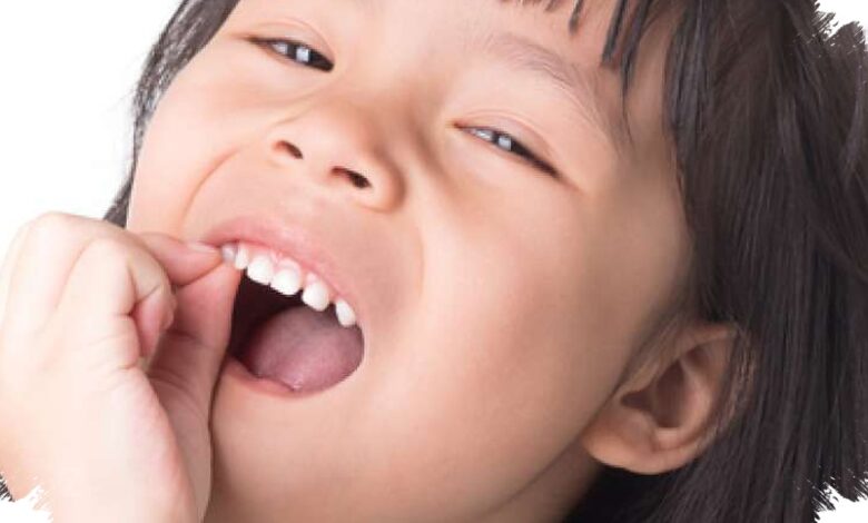 Gigi Berlubang Bukan Cuma Soal Nyeri, Ini Dampak yang Diam-Diam Ganggu Tumbuh Kembang Anak