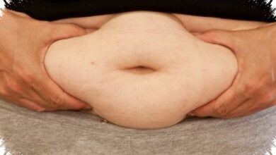 Obesitas Bukan Sekadar Gemuk, Risiko Jantung dan Kanker yang Sering Diremehkan