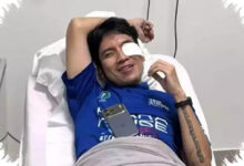 Desta Alami Pendarahan Sampai Lensa Mata Usai Bola Padel Menghantam Wajahnya