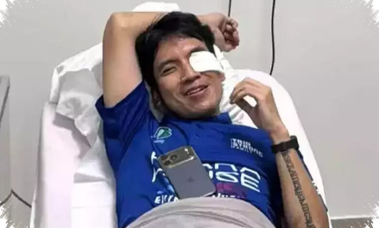 Desta Alami Pendarahan Sampai Lensa Mata Usai Bola Padel Menghantam Wajahnya
