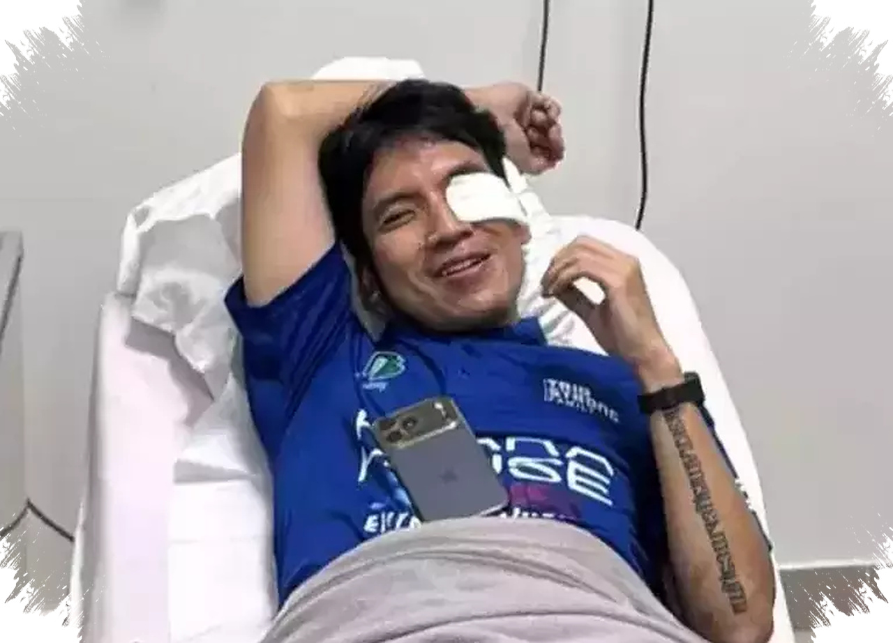 Desta Alami Pendarahan Sampai Lensa Mata Usai Bola Padel Menghantam Wajahnya