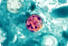 Wabah Cyclospora di Michigan Tembus 1.000 Kasus, Sumber Penularan Masih Dicari