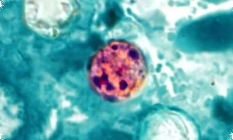 Wabah Cyclospora di Michigan Tembus 1.000 Kasus, Sumber Penularan Masih Dicari