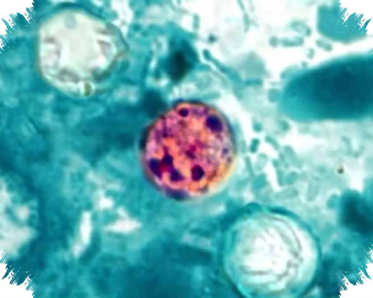 Wabah Cyclospora di Michigan Tembus 1.000 Kasus, Sumber Penularan Masih Dicari