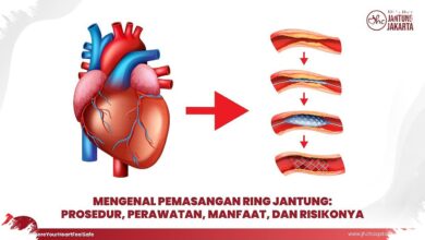 Lesi Bifurkasi Bikin Pemasangan Ring Jantung Lebih Rumit, Ini Penyebabnya