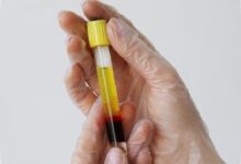 Indonesia Bangun Bank Plasma Pertama, Langkah Baru untuk Obat Derivat Plasma