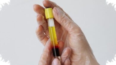 Indonesia Bangun Bank Plasma Pertama, Langkah Baru untuk Obat Derivat Plasma