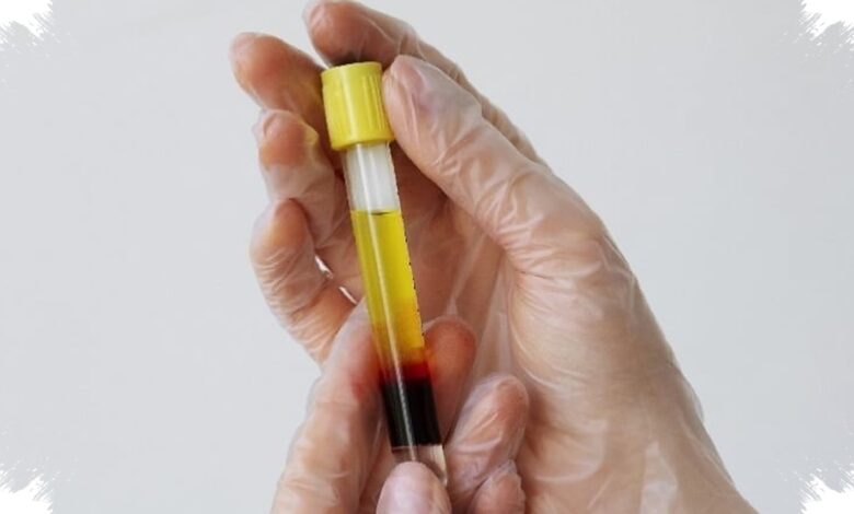 Indonesia Bangun Bank Plasma Pertama, Langkah Baru untuk Obat Derivat Plasma