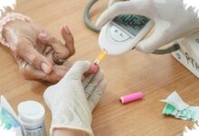 Karies Gigi Menyerang Lebih dari 40% Anak, Risiko Kesehatan yang Tak Boleh Diabaikan