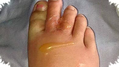 8 Tanda Tubuh Kelebihan Garam, dari Kaki Bengkak sampai Jantung Berdebar