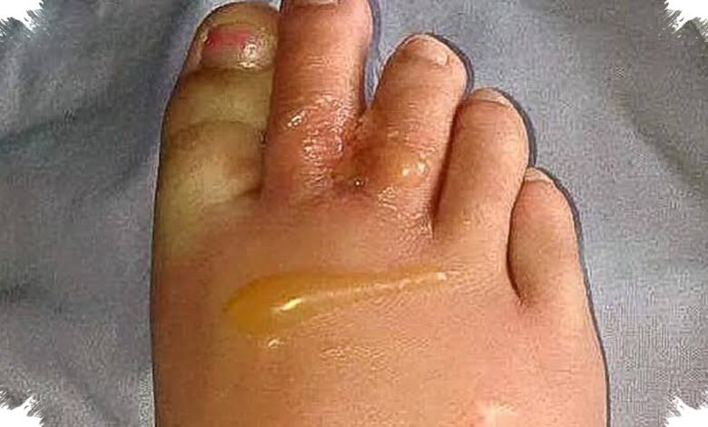 8 Tanda Tubuh Kelebihan Garam, dari Kaki Bengkak sampai Jantung Berdebar