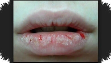 Bibir Makin Kering Setelah Lip Balm, 4 Bahan Ini Bisa Mengikis Pelindung Alaminya