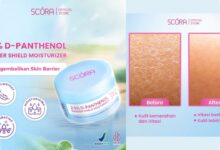 5 Pelembap untuk Kulit Kering Sensitif, Andalkan Skin Barrier agar Tak Mudah Iritasi