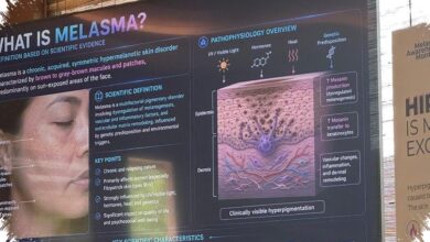 Melasma Mudah Kambuh di Kulit Tropis, Sinar Matahari Bukan Satu-Satunya Pemicu