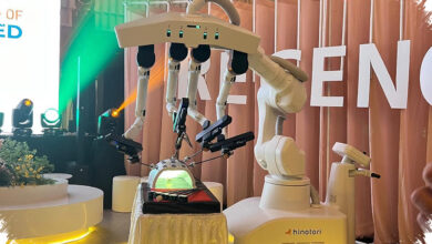 5 Keunggulan Bedah Robotik, Presisi Milimeter hingga Rawat Inap Lebih Singkat