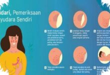 Terapi Presisi Mengubah Peluang Pasien Kanker Perempuan, Pengobatan Tak Lagi Seragam