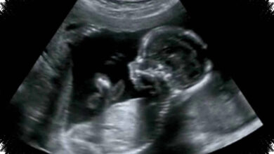 Jantung Janin Terbentuk Sejak Trimester Pertama, Obat Sembarangan Bisa Berisiko